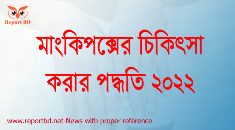 মাংকি পক্স হলে কি গোসল করা যাবে, পক্স হলে কি দোয়া পড়তে হয়, মাংকি পক্স হলে কি খাওয়া উচিত, মাংকি পক্স এর ঔষধ, মাংকি পক্স কতদিন থাকে, পক্স কত প্রকার, মাংকিপক্স ছবি, মাংকি পক্স হলে করণীয় কি,