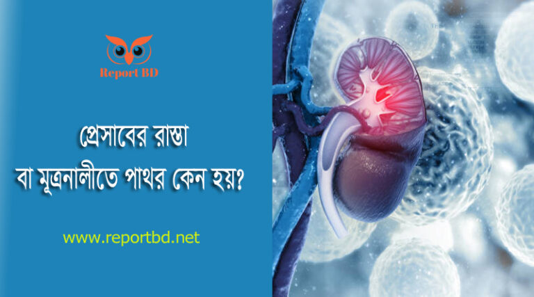 মূত্রনালীর পাথর অপারেশন খরচ বাংলাদেশ । মূত্রনালীর পাথর দূর করার উপায় কি?
